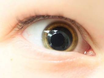 Causes and treatment for dilated pupils