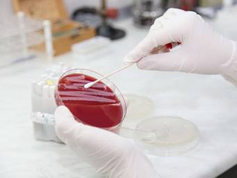 Antibiotic resistance: 8,000 new drug combinations are effective