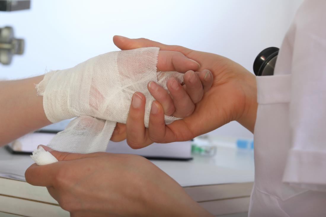 dissolvable stitches wound dressing